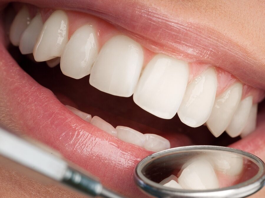 Καθαρισμός εμφυτευμάτων